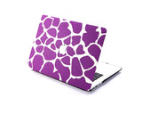 Matt Series MacBook Air Hard Case - Giraffe